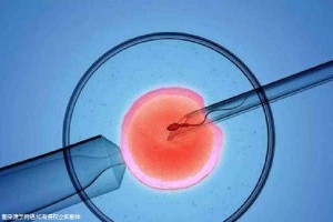 代怀供卵自怀医院生殖中心